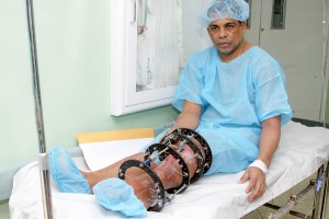 A José Martín Mella Santana, de 52 años, cuya pierda fue fracturada en tres parte le han realizado cuatro operaciones.